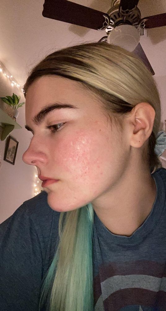 Grace after: left side