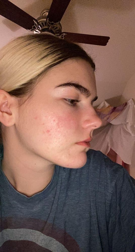 Grace after: right side