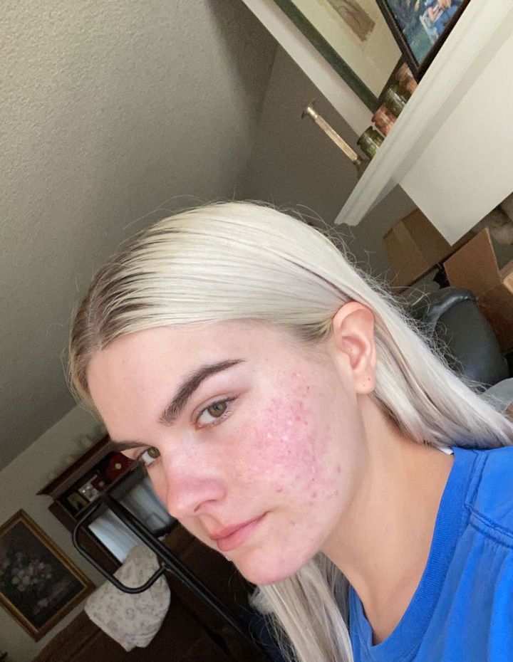 Grace after, platinum hair and a blue shirt