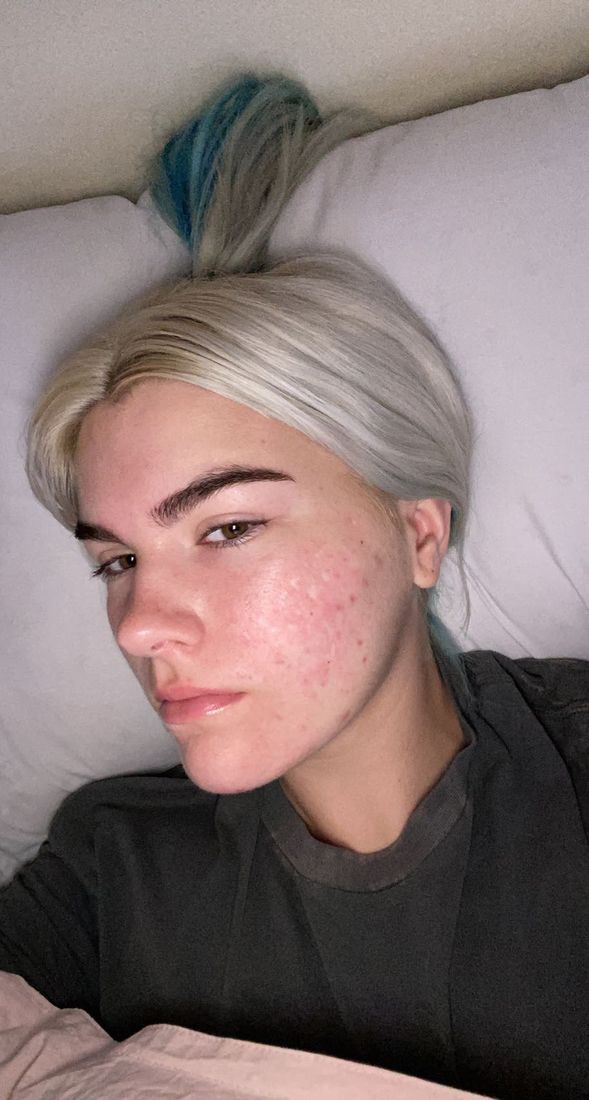 Grace after, platinum hair, lying on a pillow