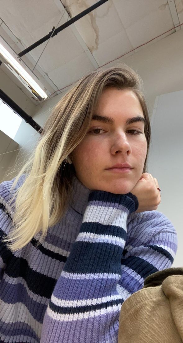 Grace two years later, in a purple striped sweater, skin clear